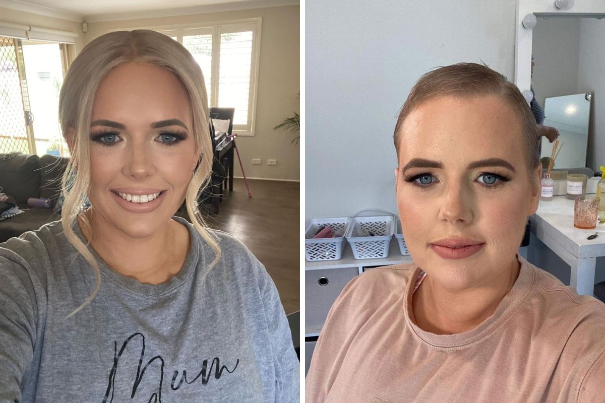 Ból pleców okazał się symptomem rzadkiego nowotworu