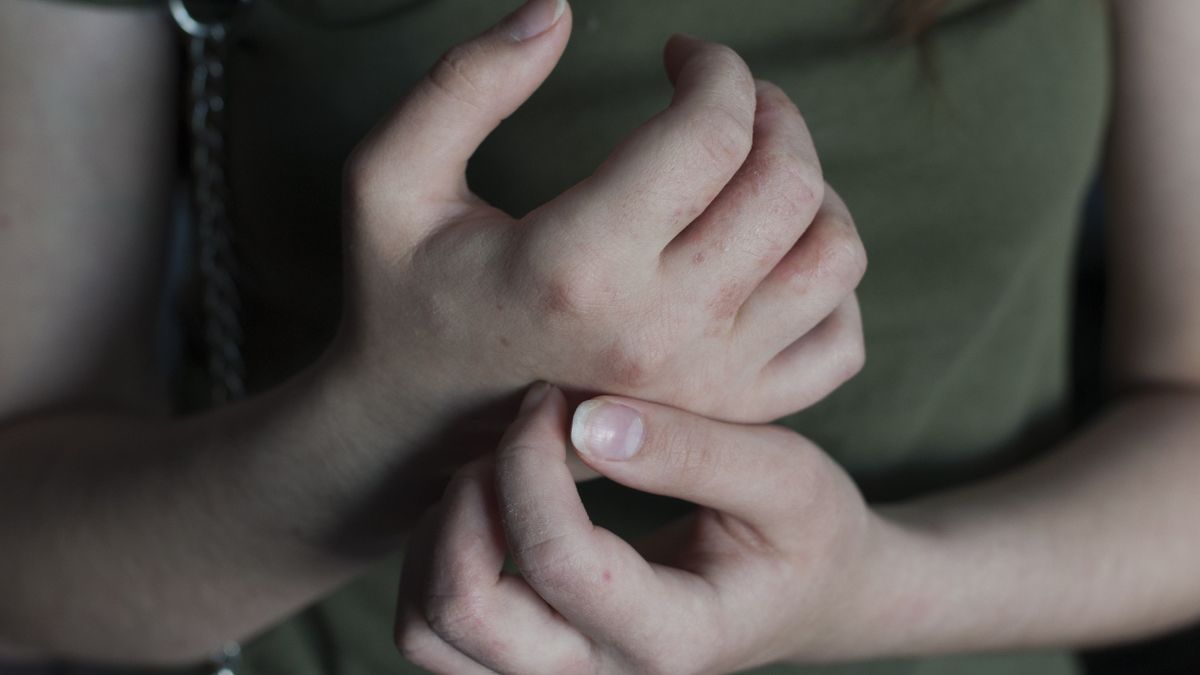 Jeśli jesz za dużo cukru pojawiają się niepokojące sygnały
