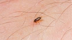 Ugryzienie pchły - jak wygląda, leczenie, jakie choroby przenoszą pchły