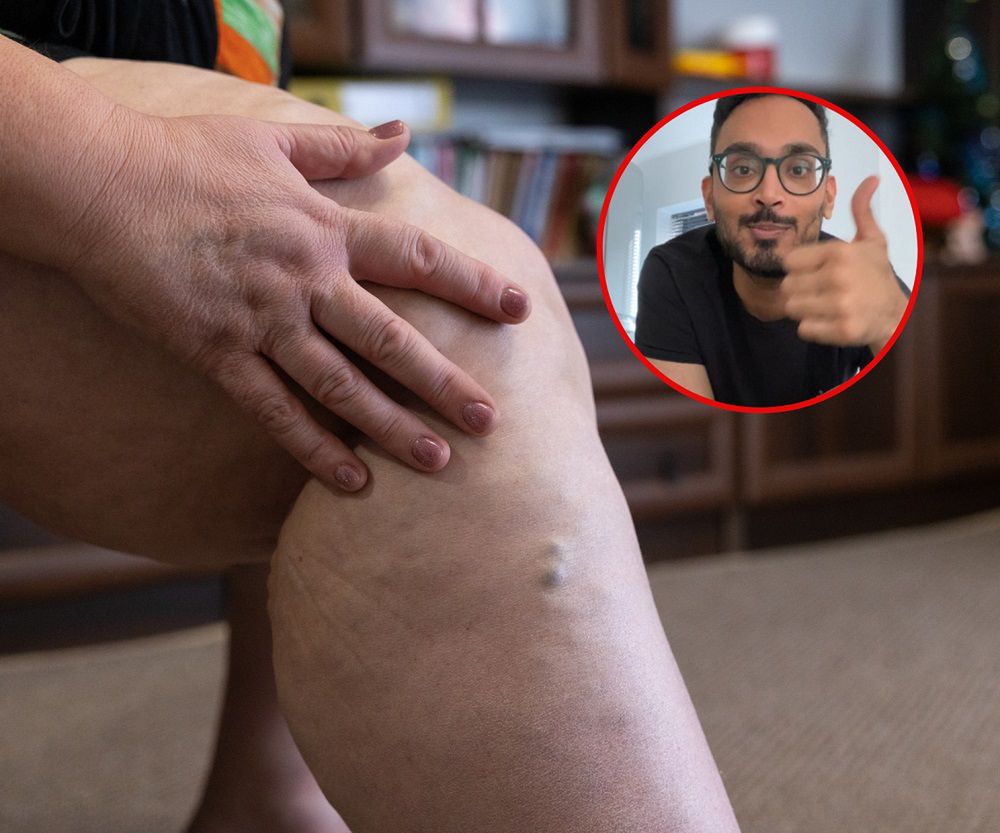 Pij, by uniknąć zakrzepicy. "Zmniejsza ryzyko tworzenia się skrzepów w żyłach"