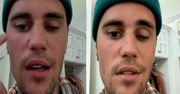 Justin Bieber boryka się z poważną chorobą. Piosenkarz ma sparaliżowaną twarz