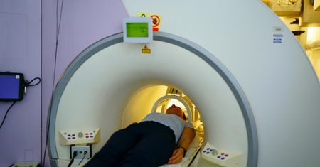 Najtrudniejszy przeciwnik neurochirurgów. Glejaki dominują w statystykach i mają złe rokowania