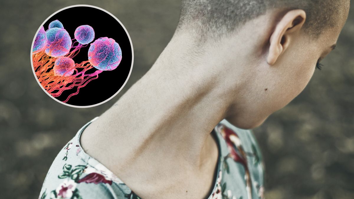 Nowatorska metoda może uratować życie pacjentów onkologicznych