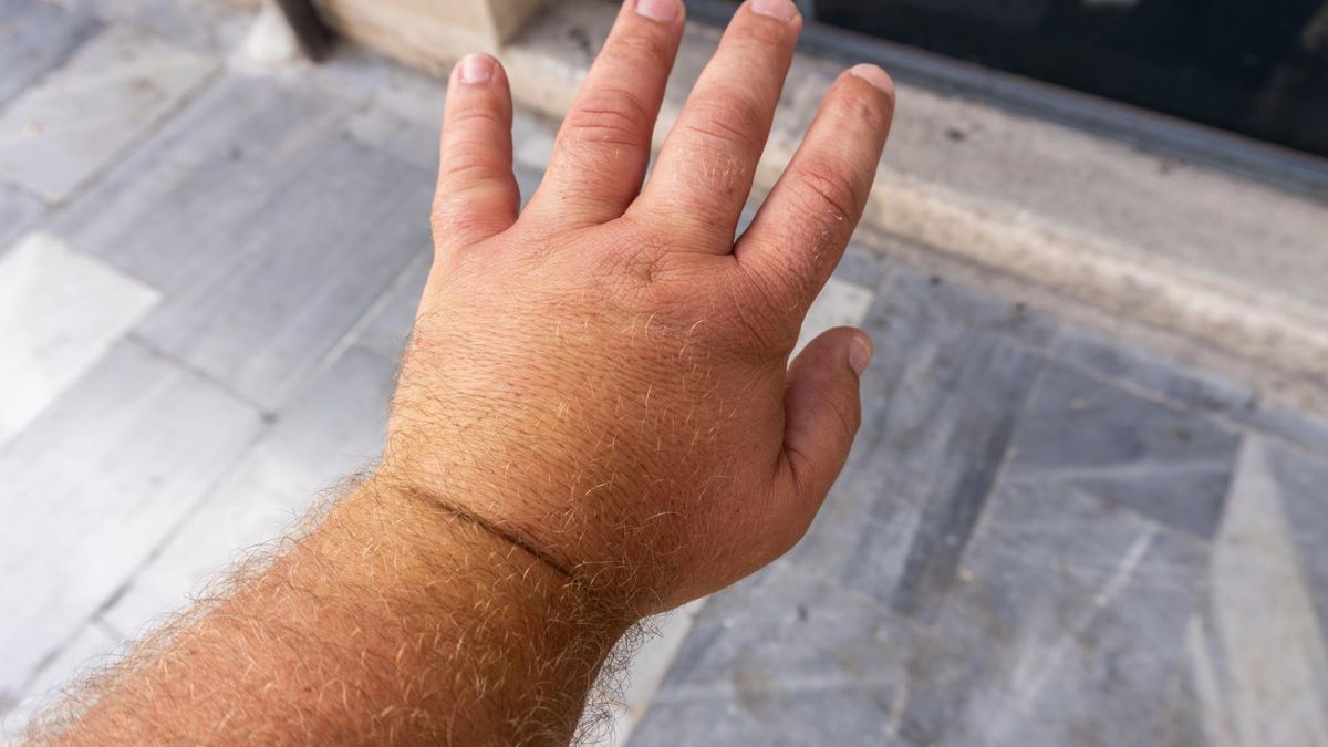 Mało znany objaw raka płuc. Lekarz ostrzega przed zmianami na palcach