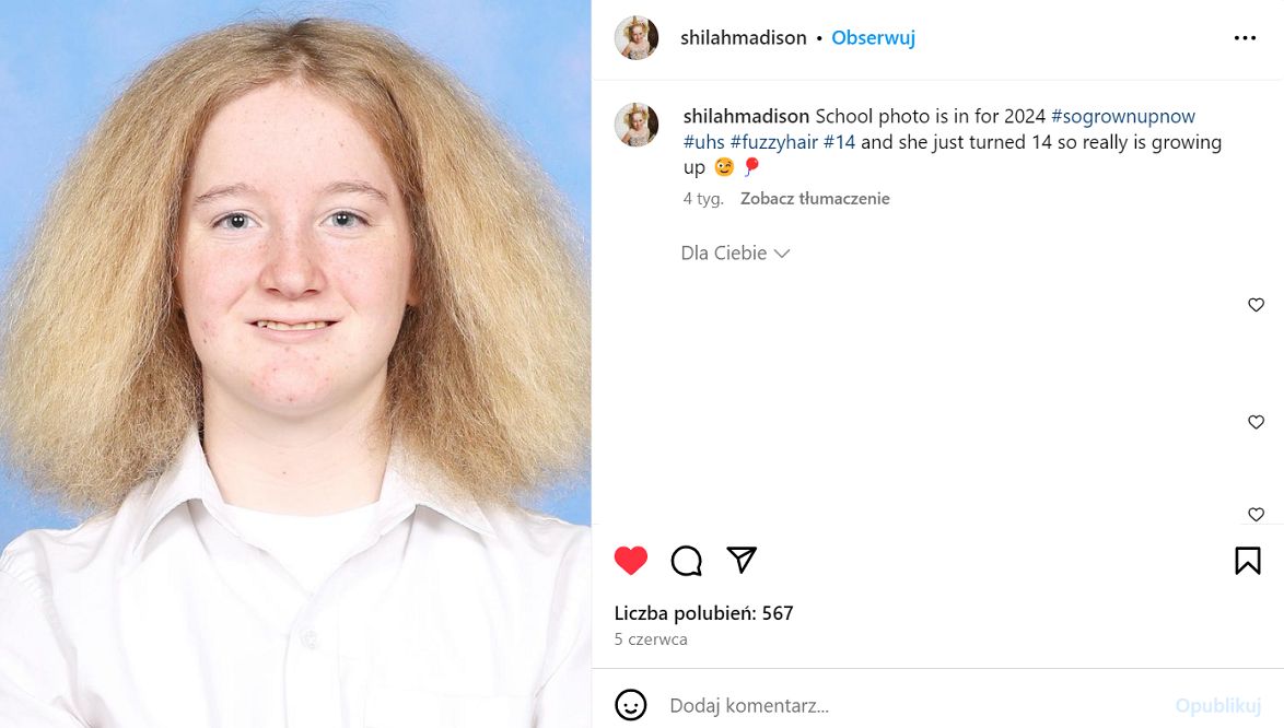 Shilah ma już 14 lat