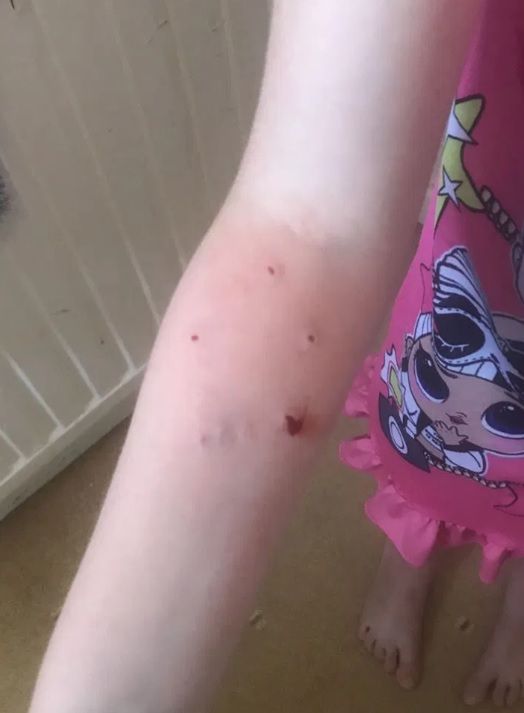 Rany Alice Hudson nie goiły się