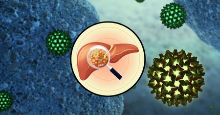 Wirusowe zapalenie wątroby typu A (WZW) - przyczyny, leczenie, epidemia
