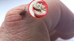 Kleszczom wyjątkowo śmierdzi ten zapach. Będą uciekać w popłochu