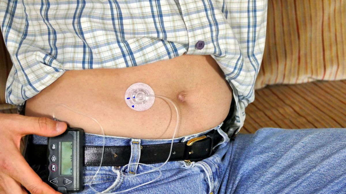 Czym jest insulina analogowa?