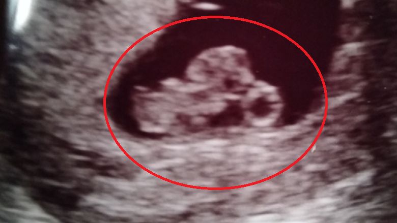 Zdjęcie USG rozbawiło internautów. "Mam nadzieję, że przyjdzie na świat w skórzanej kurtce"