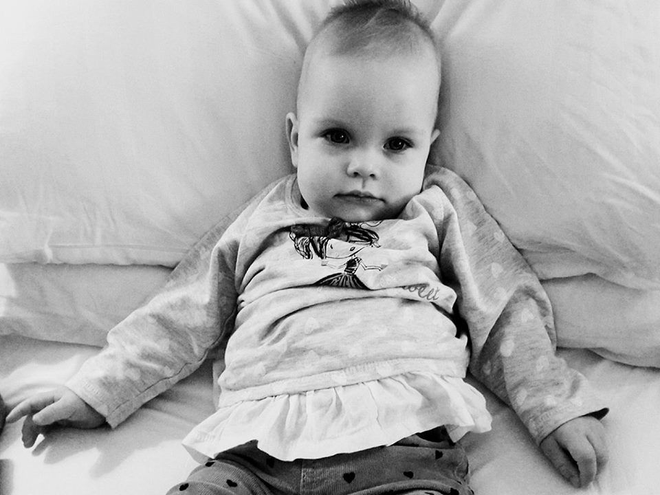 Malutka Izabela cierpi na stwardnienie guzowate