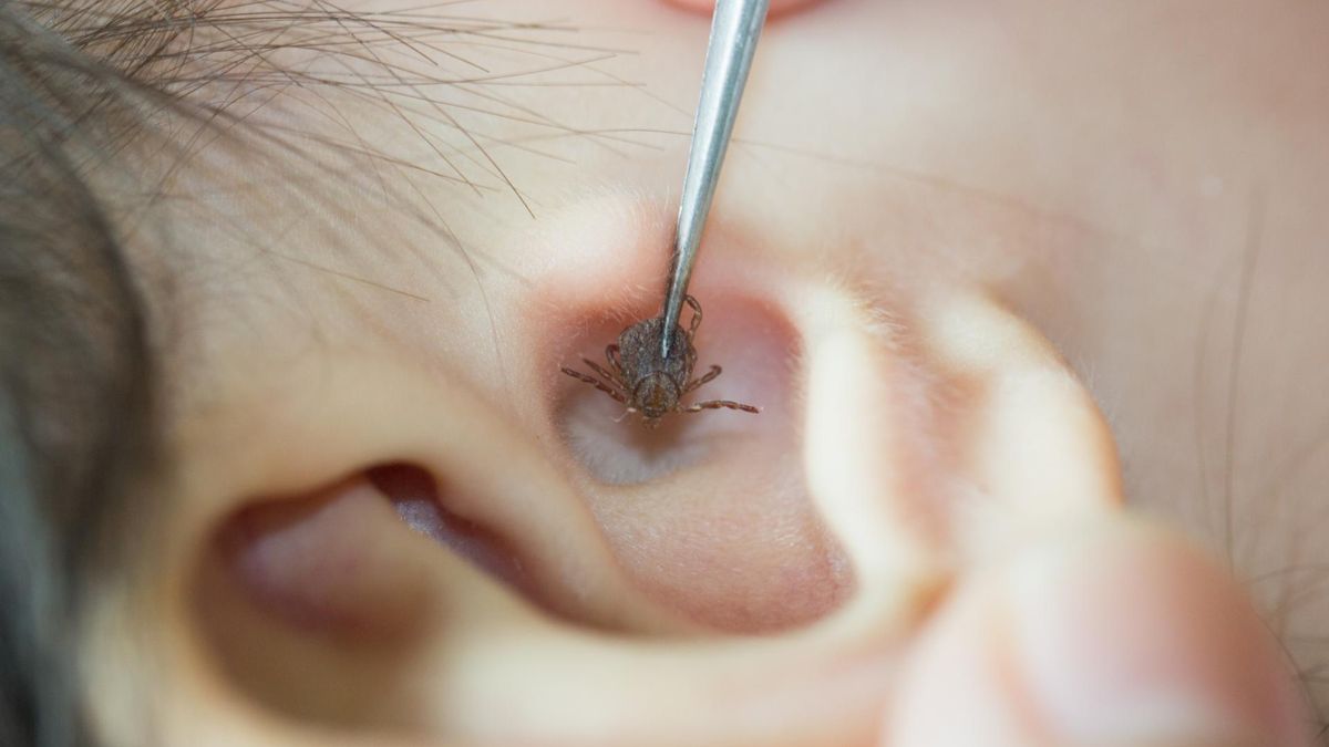 Uwaga na kleszcze. Można je przynieść nie tylko ze spaceru po lesie. Żyją również na łąkach i w parkach