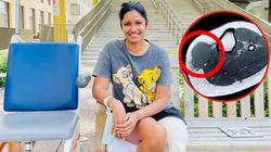 Pierwszym objawem był mały, bezbolesny guzek. Niedługo później musiała przejść amputację nogi