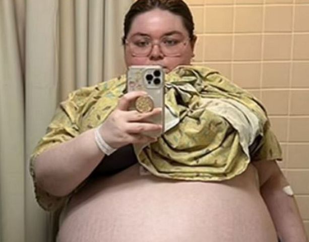 Czuła, jakby była w ciąży z 10. dzieci. Guz ważył prawie 50 kg