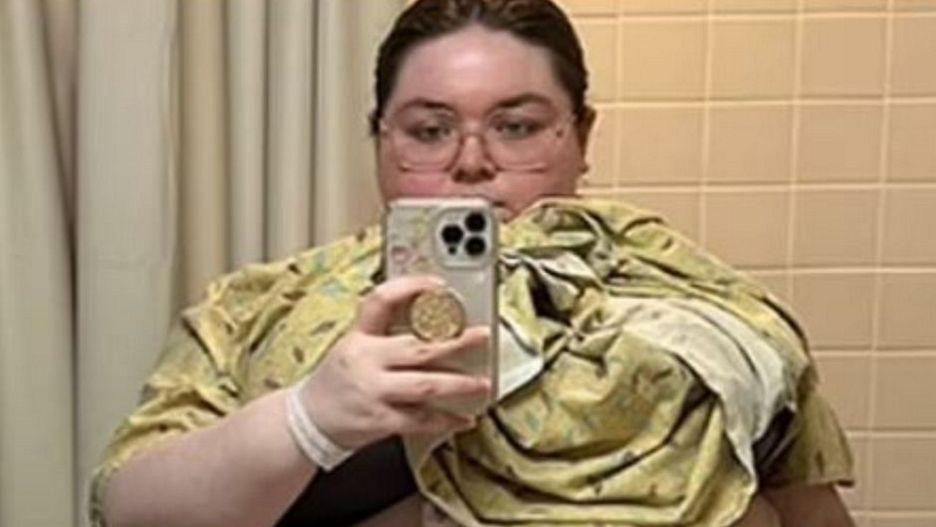 Czuła, jakby była w ciąży z 10. dzieci. Guz ważył prawie 50 kg