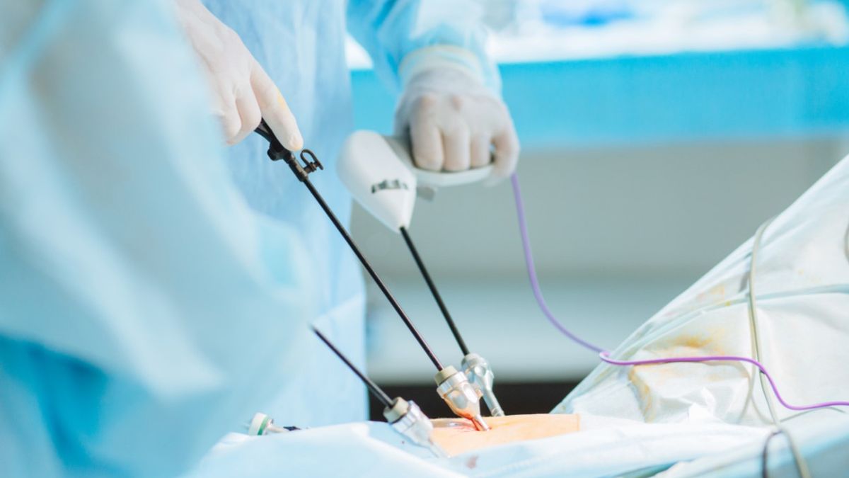 Laparoskopia - wskazania, przygotowanie, przebieg