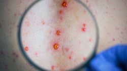 USR - charakterystyka, wskazania do badania, opis badania, interpretacja wyników