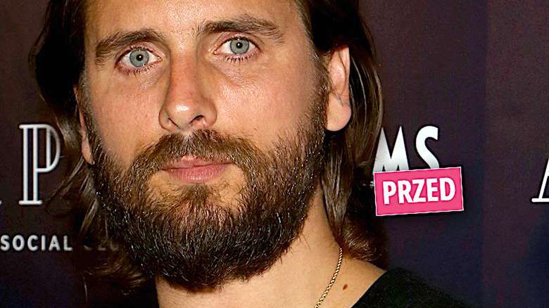 Scott Disick metamorfoza