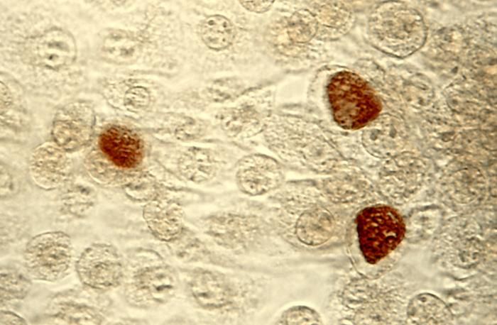 Komórki Chlamydia trachomatis 