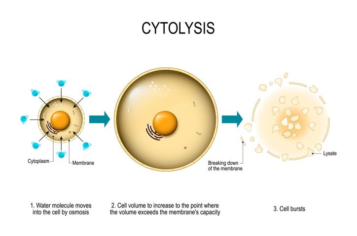 Cytoliza to rozpad struktur komórkowych, które utrudniają prawidłową ocenę cytologiczną