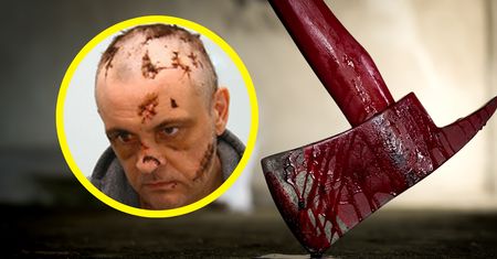 Zadała mężowi 126 ciosów siekierą. Przeżył. Lekarze mówią o cudzie
