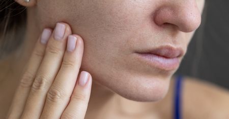 "Pogromca" suchej skóry z apteki. Kupisz za kilka złotych