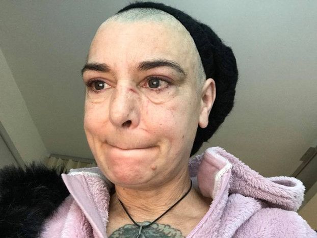 Sinead O'Connor żali się, że POBIŁ JĄ WŁASNY SYN! "Jesteś zwykłym gó*nem, które pobiło własną matkę!"