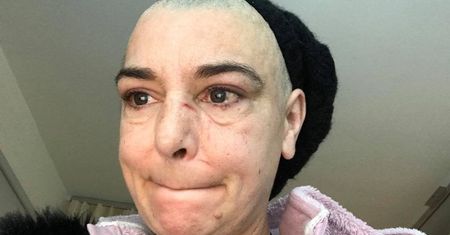 Sinead O'Connor żali się, że POBIŁ JĄ WŁASNY SYN! "Jesteś zwykłym gó*nem, które pobiło własną matkę!"