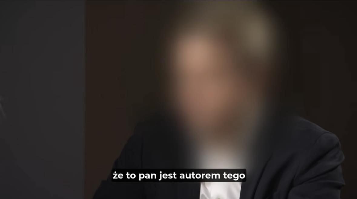Poddali się przeszczepowi włosów w polecanej klinice
