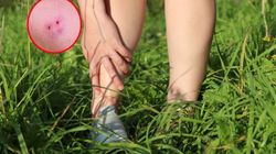 Ratownicy i lekarze ostrzegają przed żmijami. Błąd może kosztować życie