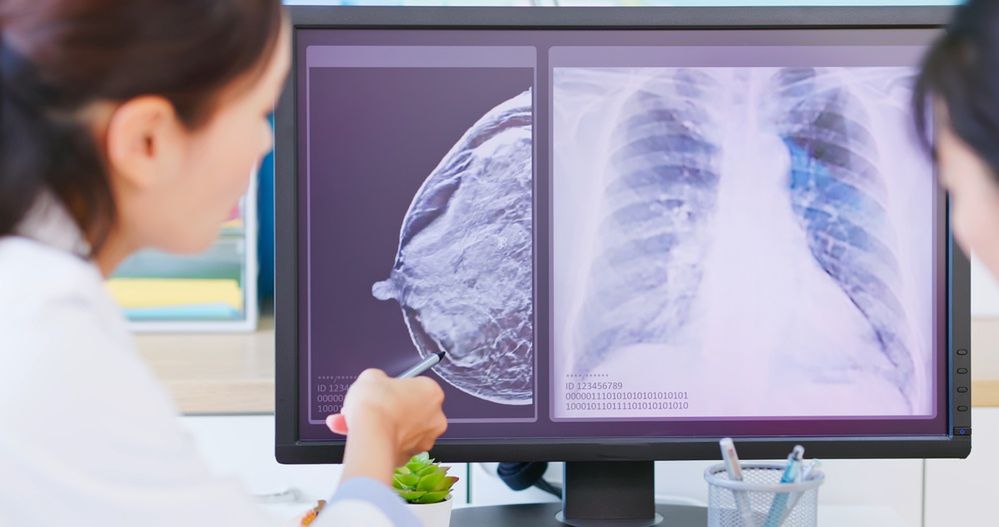 To najczęstszy nowotwór u kobiet w Polsce. Coraz więcej badań potwierdza związek ze smogiem