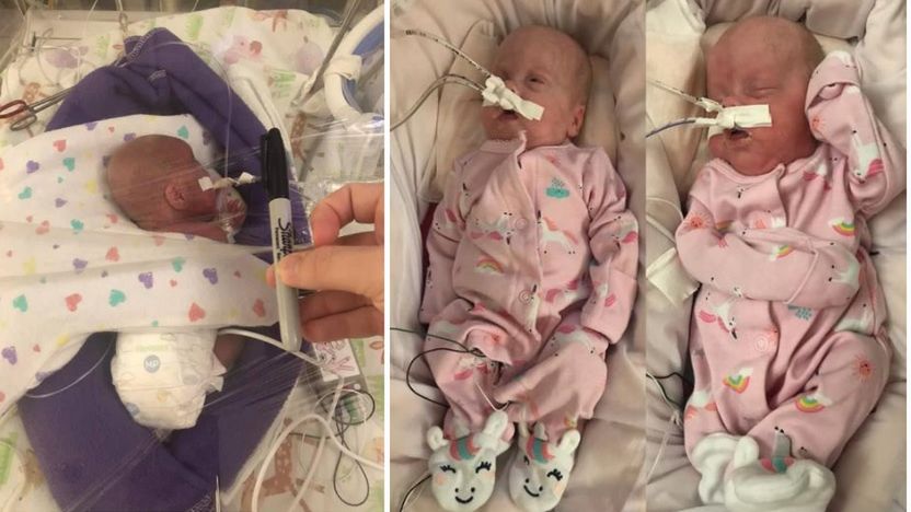 Bliźniaczki urodzone w 22.tygodniu ciąży wkrótce opuszczą szpital