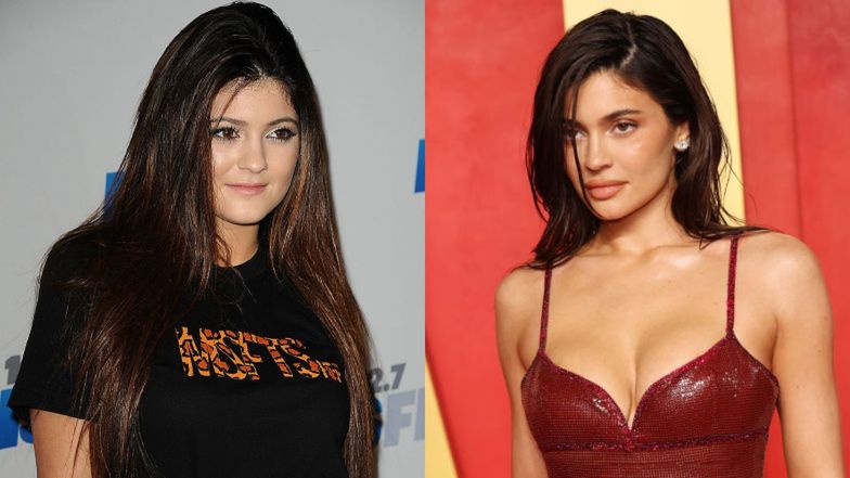 Te zdjęcia Kylie Jenner dzieli 12 lat i jeszcze więcej operacji