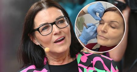 Ilona Felicjańska poddała się zabiegowi BLEFAROPLASTYKI. Pokazała zdjęcia