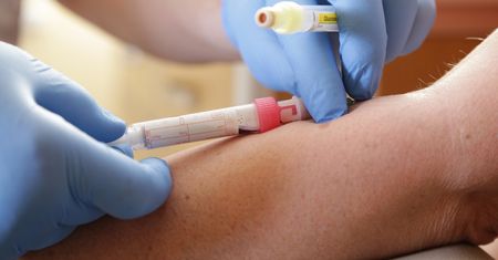 FibroTest - wskazania, przebieg, cena, interpretacja wyników, FibroMax