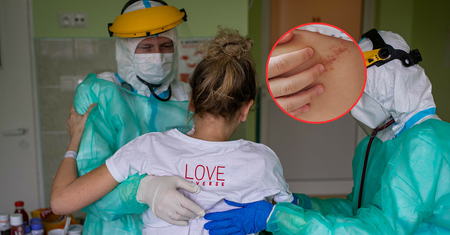 Rekordowa liczba zakażeń paciorkowcami. "Stan pacjentów pogarsza się błyskawicznie"