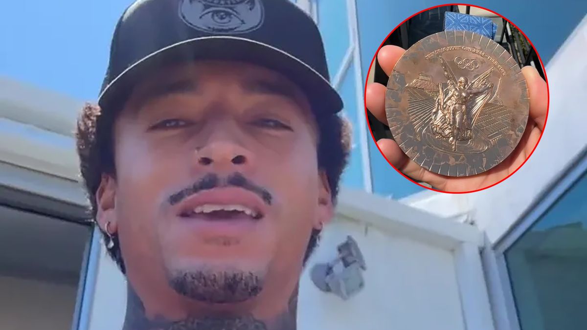 Krążek amerykańskiego zawodnika wygląda bardzo źle