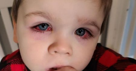 Maluch omal nie stracił wzroku. Bawił się brudnymi zabawkami do kąpieli
