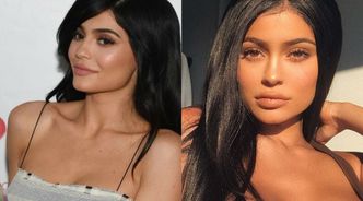 Kylie Jenner powiększyła biust? "W kilka tygodni jej piersi urosły o DWA ROZMIARY"
