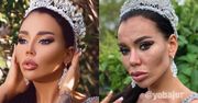 To konto na Instagramie odkrywa tajemnice celebrytów. Nie są aż tak piękni