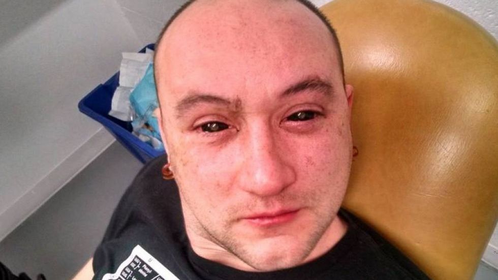 Niesamowity biohacking: krople do oczu zapewniają widzenie w ciemnościach! 1