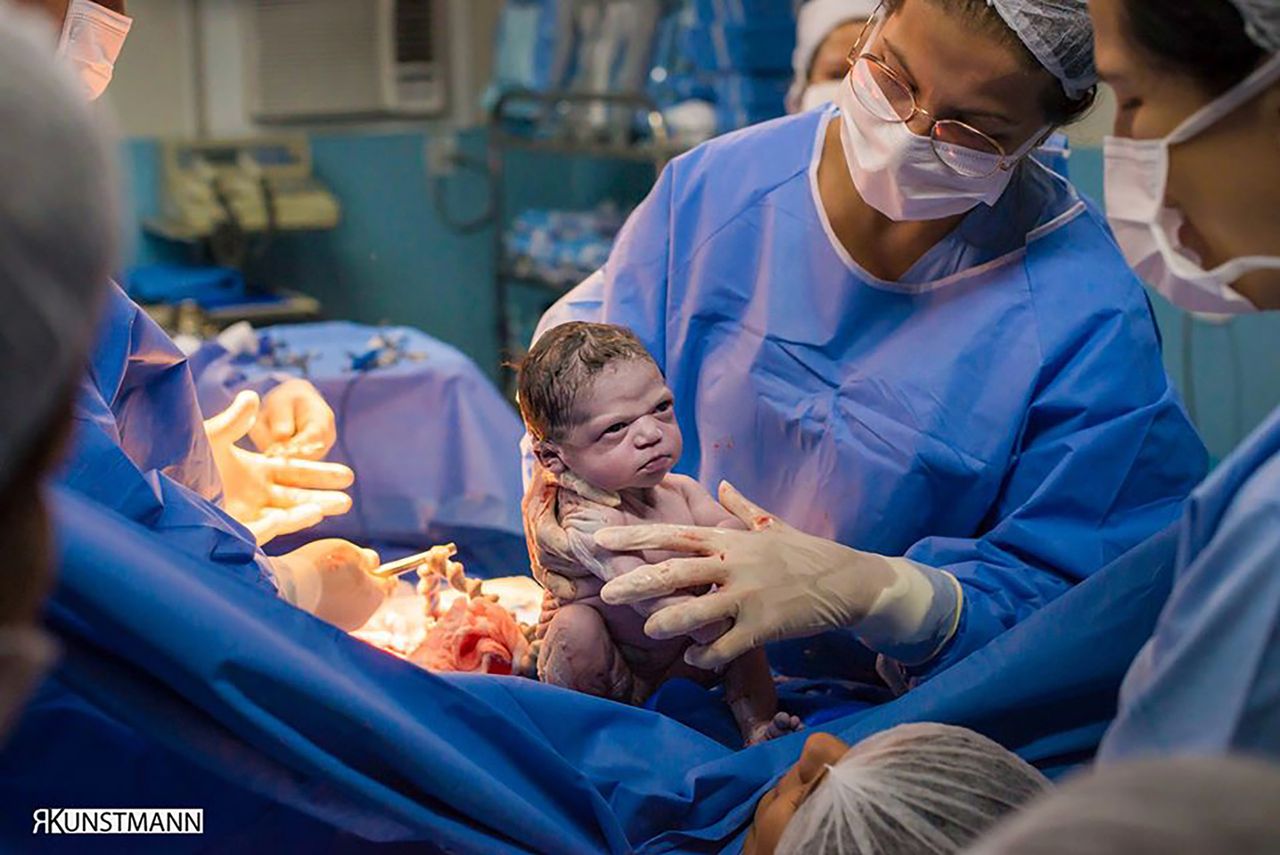 Zdjęcie noworodka patrzącego spod byka stało się hitem internetu