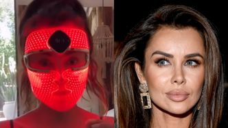 Natalia Siwiec zachwala efekty terapii światłem. Pokazała się BEZ MAKIJAŻU I FILTRÓW (FOTO)