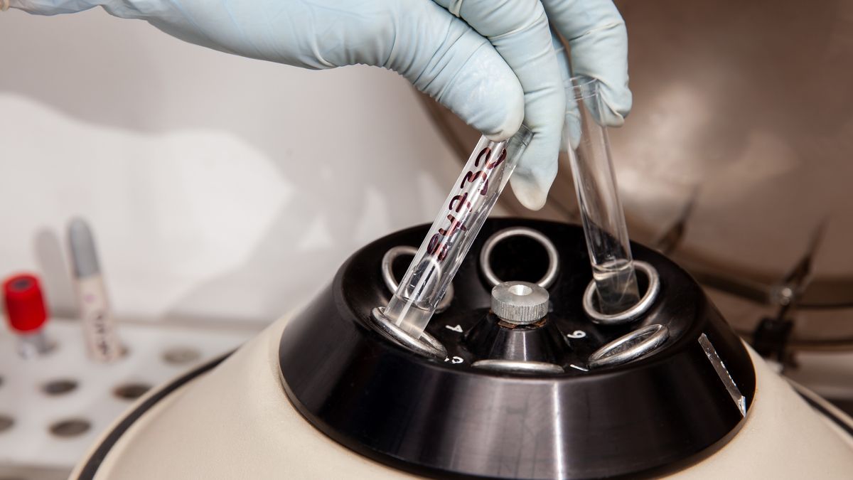 Test HPV HR jest skuteczniejszy niż cytologia