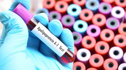 Apolipoproteina A1 (Apo A1) - co to jest, cel badania, normy, spadek, wzrost