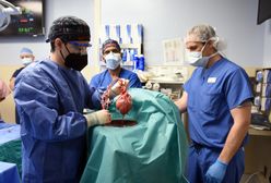 Serce świni z powodzeniem przeszczepione człowiekowi. Medyczna sensacja