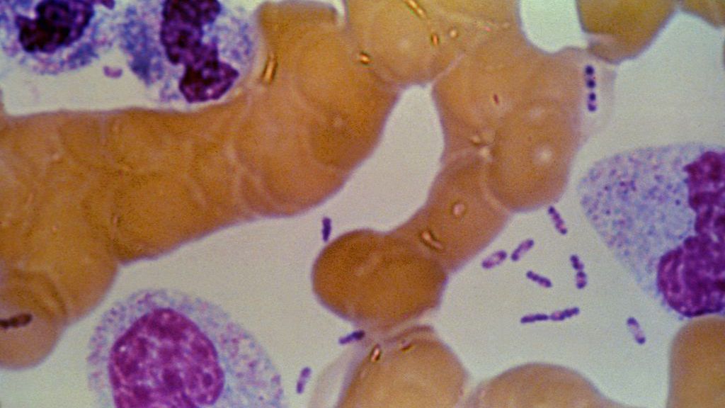 Dżuma jest wywoływana przez bakterie Yersinia pestis