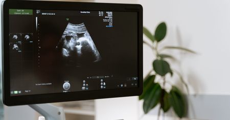 Dokonała aborcji będąc w 33. tygodniu ciąży. Usłyszała wyrok