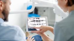 Choroba Takahary (akatalazja) - przyczyny, objawy, diagnostyka i leczenie