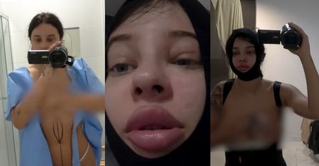 Fagata ZNOWU zrobiła sobie brazylijski lifting pośladków! "Wymiotowałam krwią..." (WIDEO)